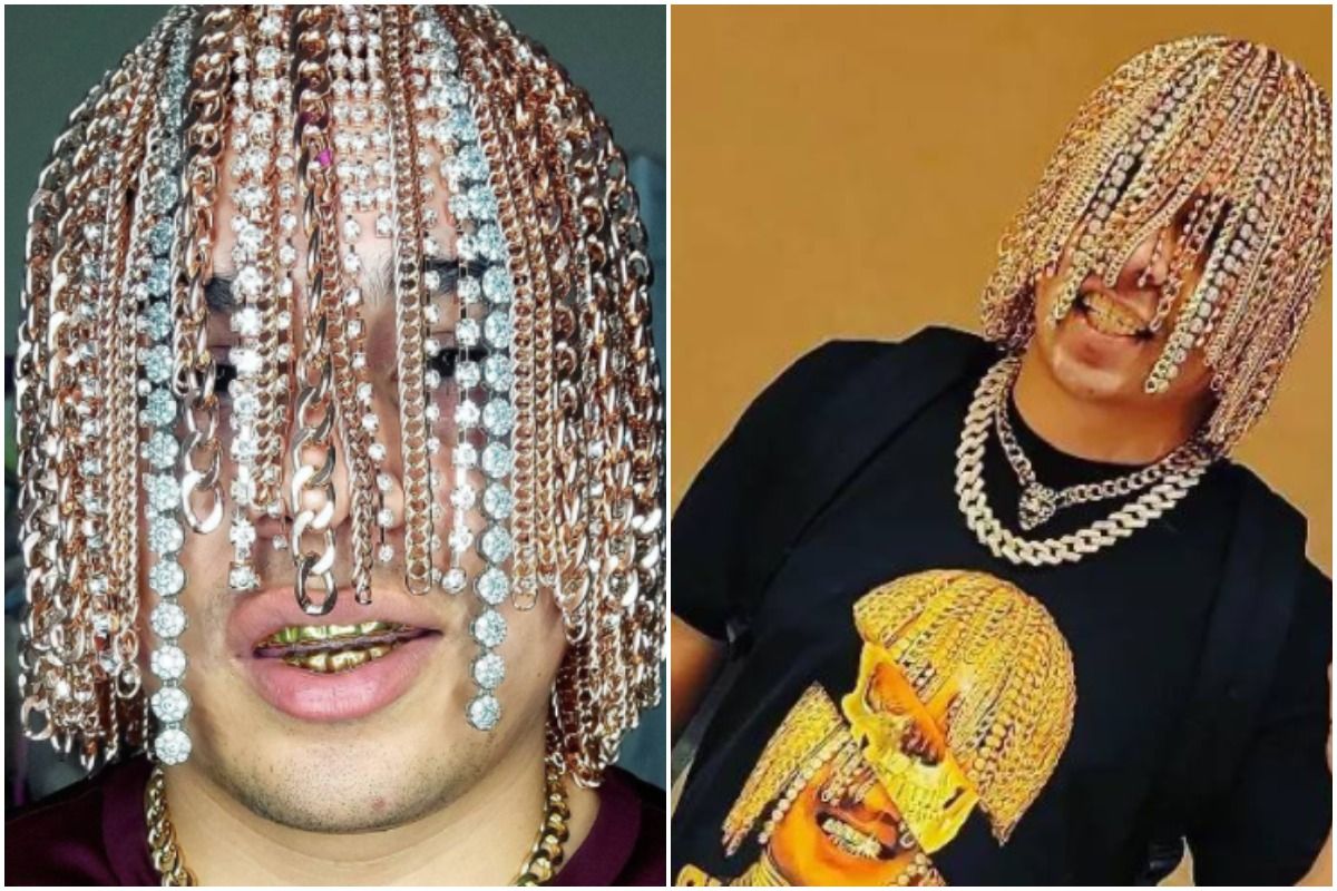 Gold Rush: Rapper Dan Sur replaces hair with surgically implanted gold chains - theentertainment.vision